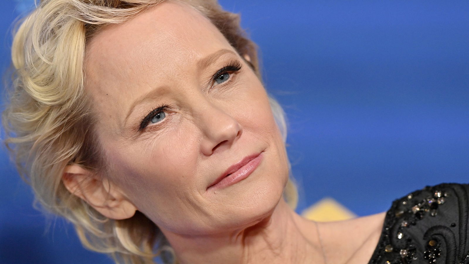 Anne Heche Is ‘Not Expected To Survive’ After Suffering Severe Brain(02)