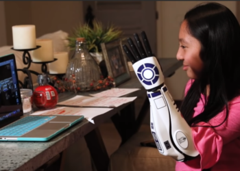 YouTube | Open Bionics