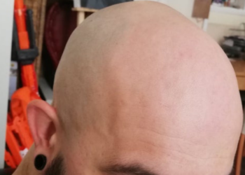 Reddit | Arkaboop