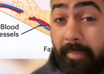 TikTok | @dr.karanr