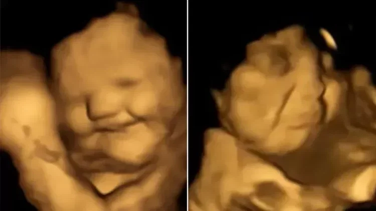 People | Durham University Fetal and Neonatal Research Lab