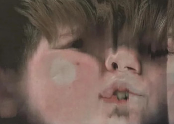 Reddit | Yeeslander
