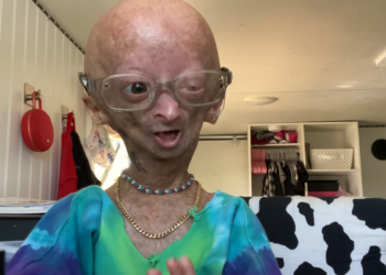 YouTube | Adalia Rose