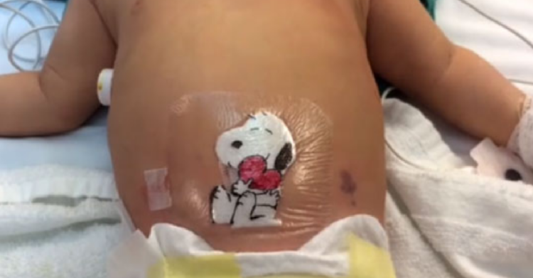 Facebook | Akron Children’s Hospital
