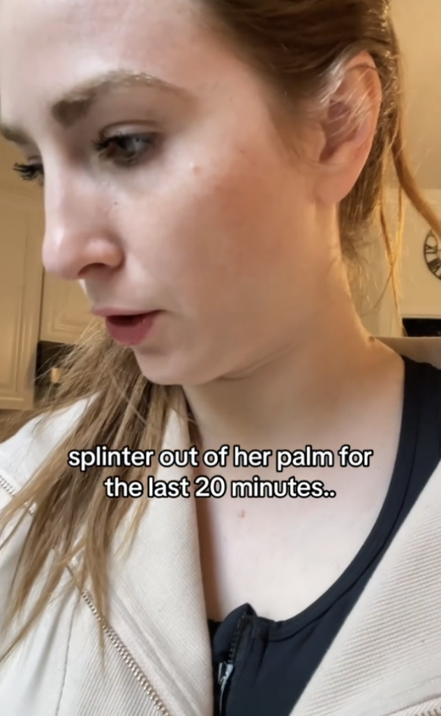 Mom's Splinter Removal TikTok Video Hack