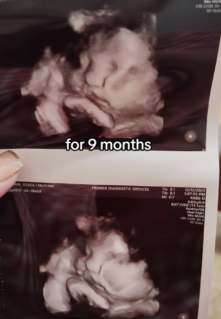 TikTok Video Ring Doorbell Baby Loss
