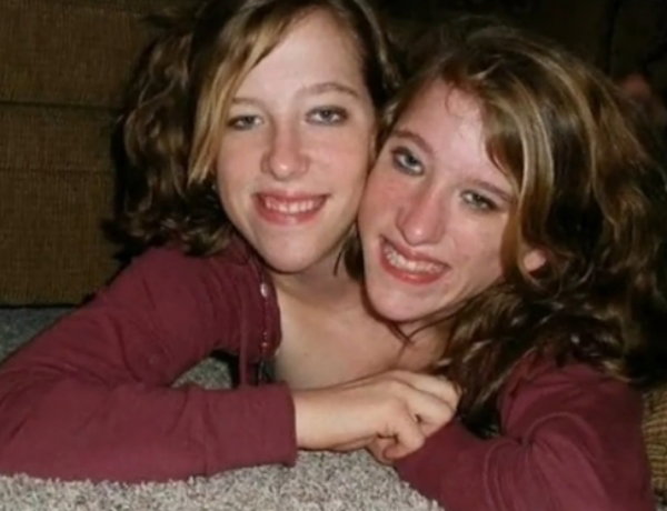 Abby and Brittany Hensel 