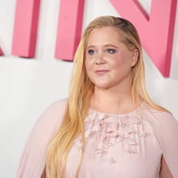 Amy Schumer, moon face, Cushing's syndrome