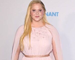 Amy Schumer, moon face, Cushing's syndrome