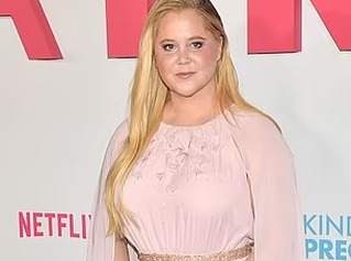Amy Schumer, moon face, Cushing's syndrome