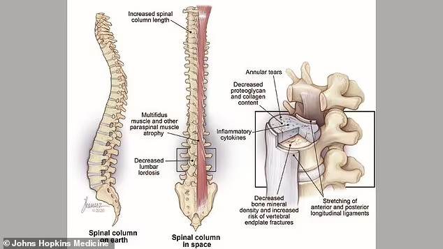 NASA Astronauts May Face a Mysterious Health Problem for the Rest of Their Lives!