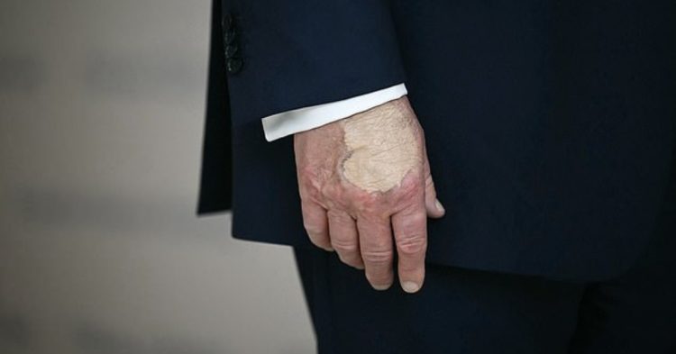 Trump hand covered in makeup