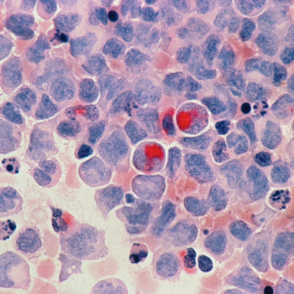 red round fruits on white and blue surface